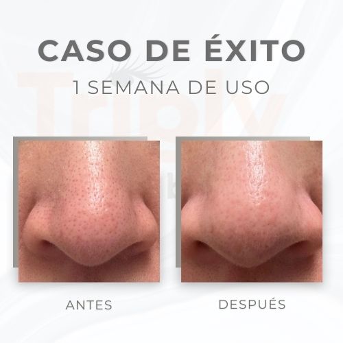 Comparativa de antes y despu&eacute;s de usar los sticks